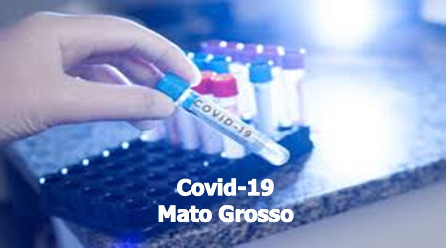 Domingo (16): Mato Grosso registra 73.115 casos e 2.377 óbitos por Covid-19 1