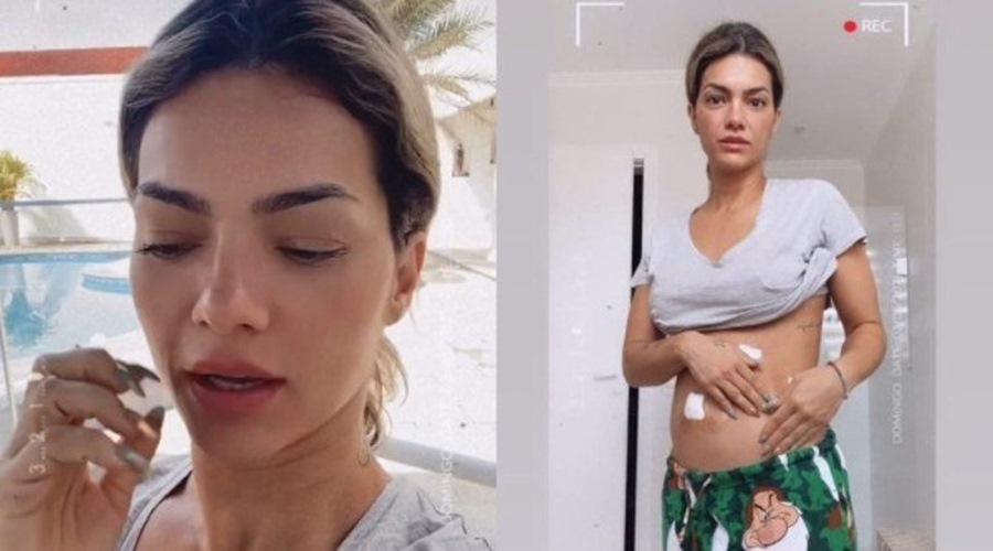 Kelly Key mostra curativos na barriga após passar por cirurgia 1