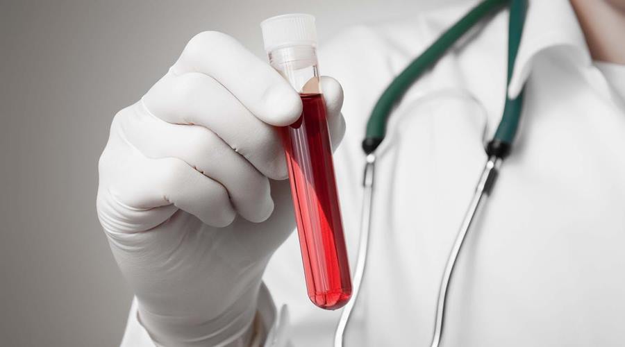 Exame de sangue é capaz de saber se você sofre de transtorno de ansiedade e até em qual grau 1